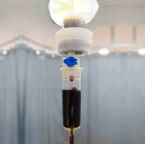 A medical Intravenous drip containing liquid Iron